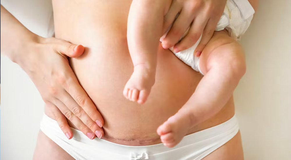 Pilates post-partum : retrouver stabilité, force et confiance dans son corps